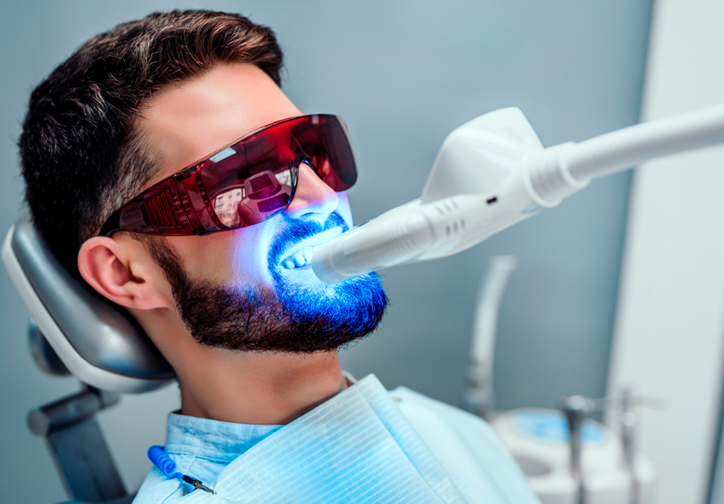 beneficios clareamento dental