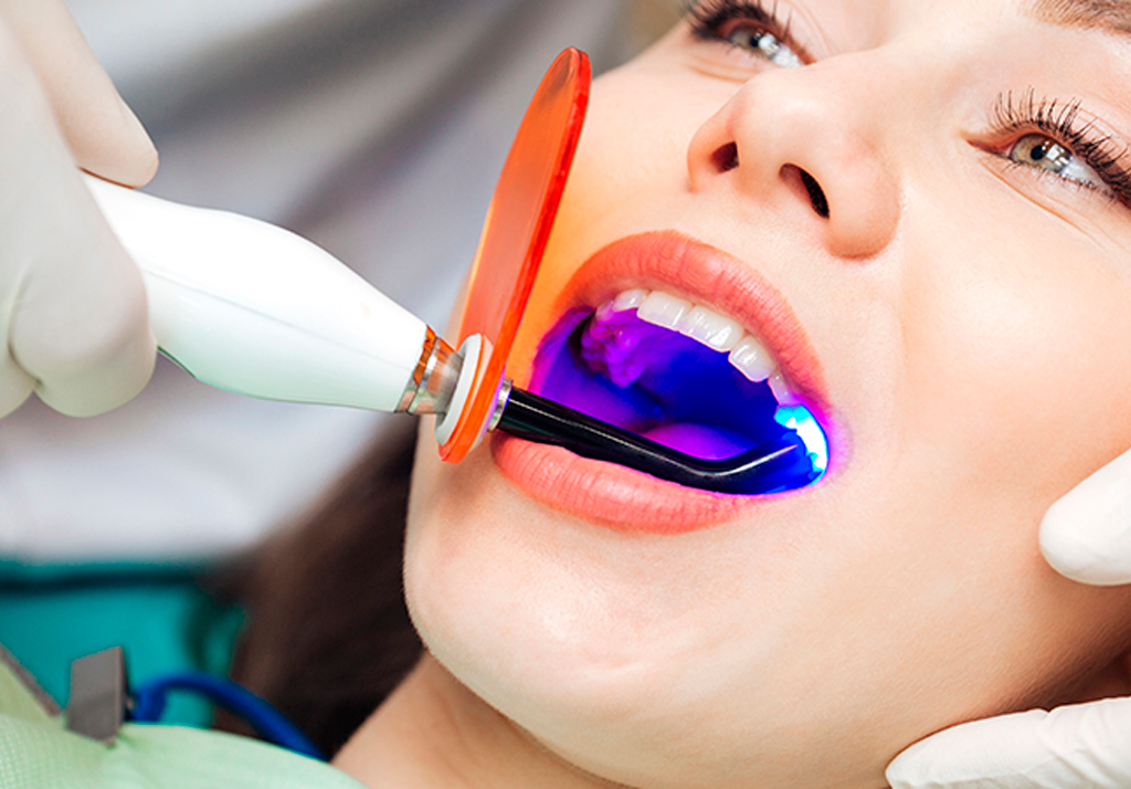 mitos clareamento dental
