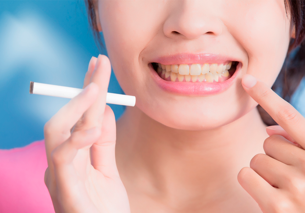 tabaco e clareamento dental